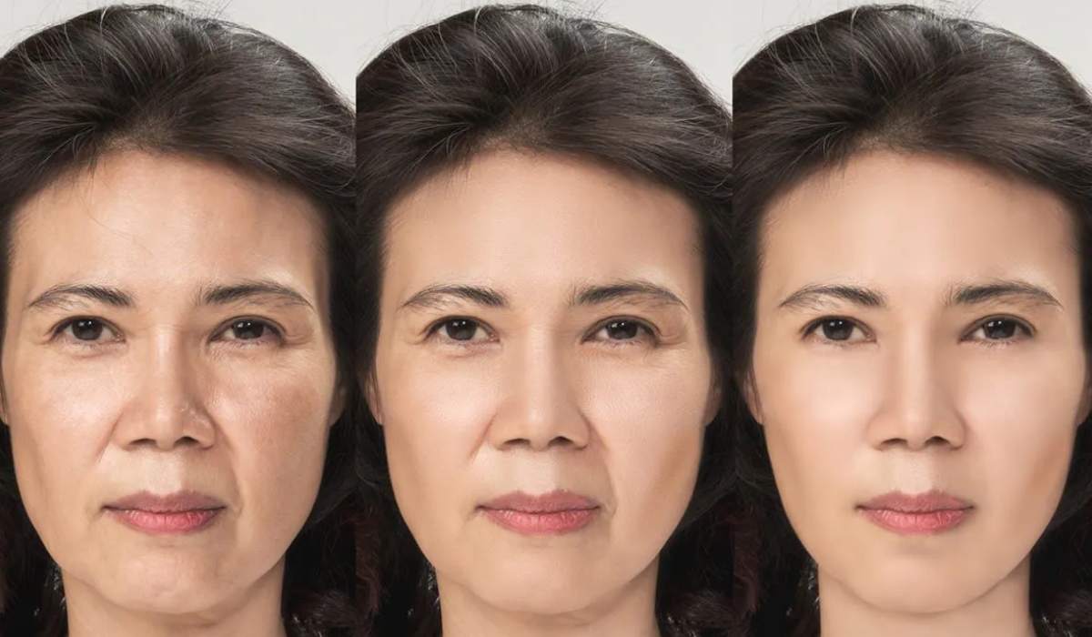 تاثیر هایفوتراپی