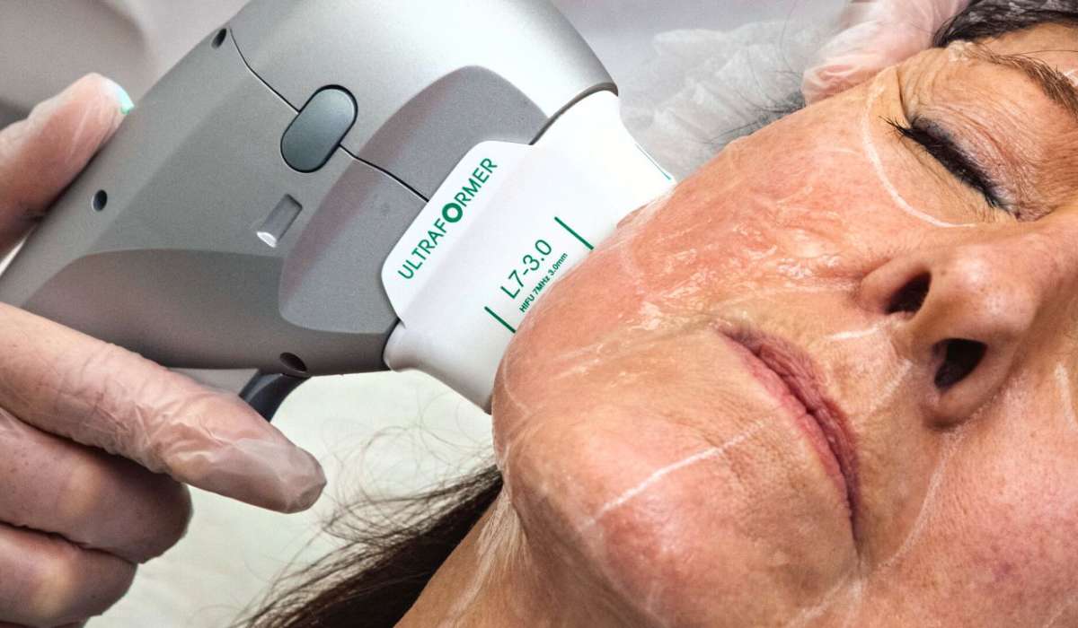 هایفوتراپی از روش های ترکیبی لیفت و جوانسازی پوست