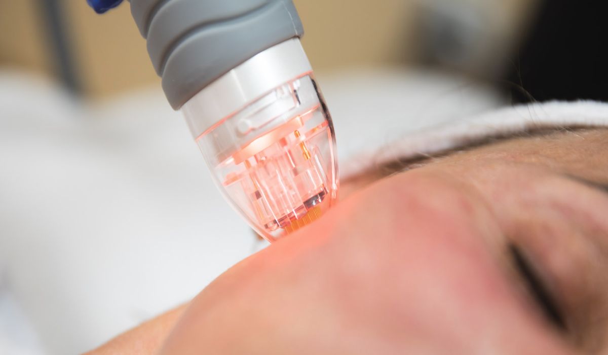 آر اف فرکشنال