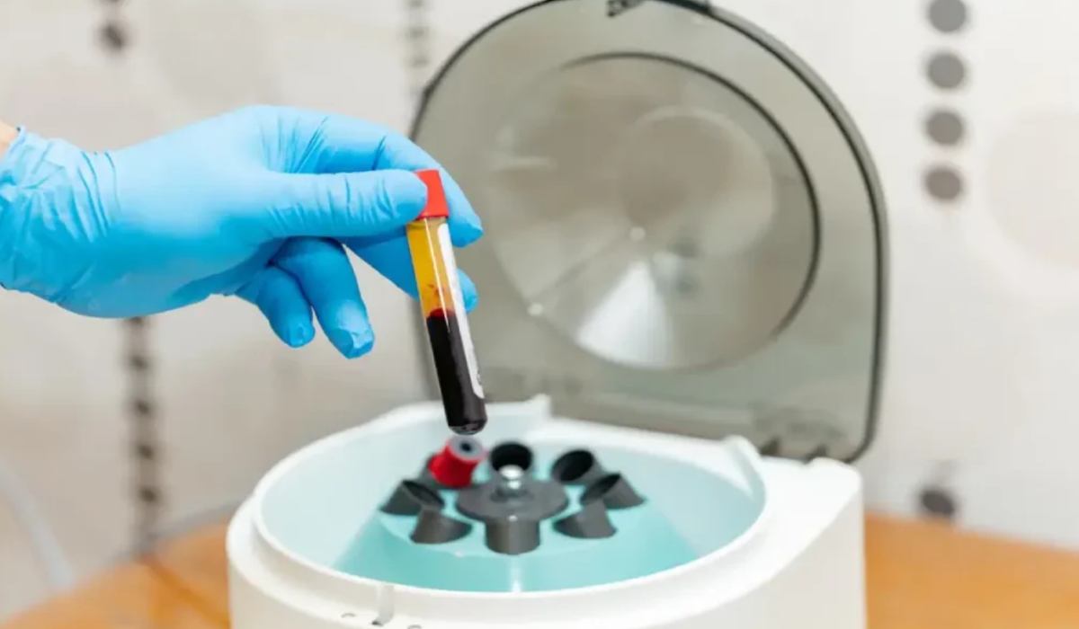 تنگ کردن واژن با روش پی‌آرپی