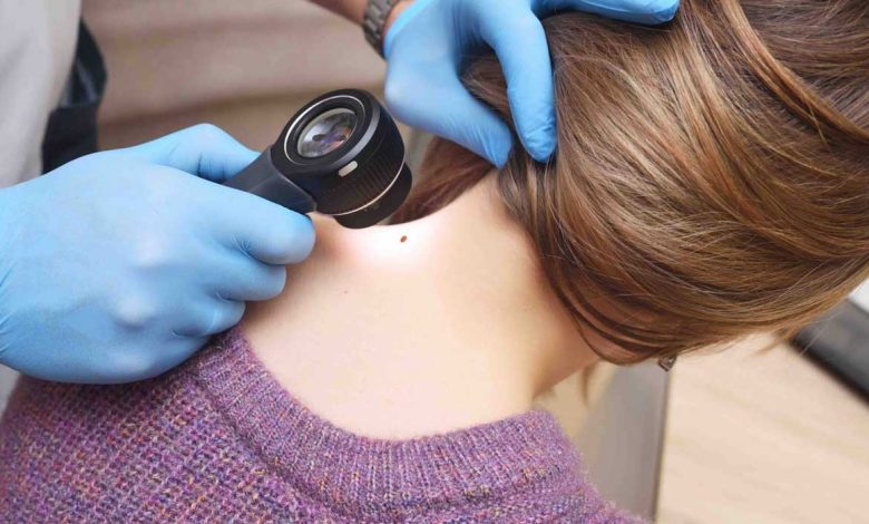 دکتر پوست کیست