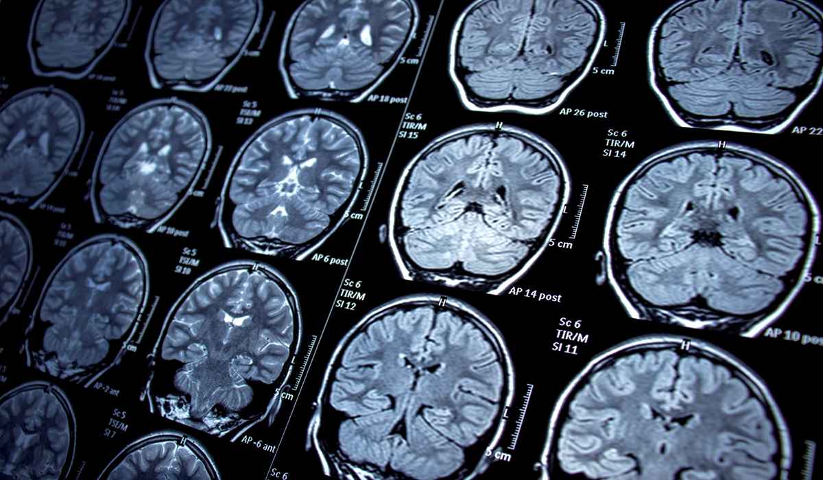 ام آر آی (mri) چیست و برای تشخیص چه بیماریهایی کاربرد دارد؟_مستطیل زرد 14 مزایای امآرآی