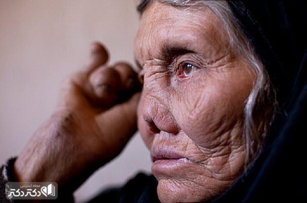 همه چیز درمورد بیماری جذام از علت و علائم تا راههای تشخیص و درمان آن_مستطیل زرد 2 علائم جذام