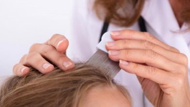 بهترین شامپوهای ضد شپش