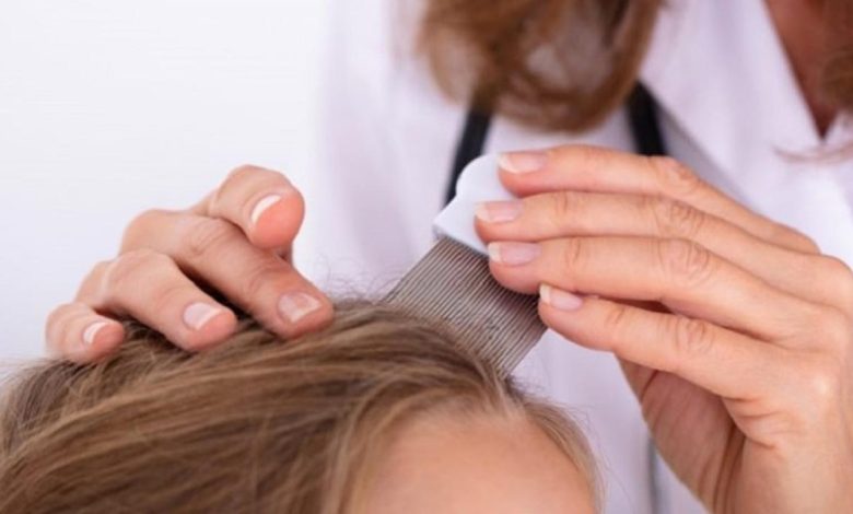 بهترین شامپوهای ضد شپش + داروهای تجویزی و بدون نسخه شپش_مستطیل زرد 23 بهترین شامپوهای ضد شپش