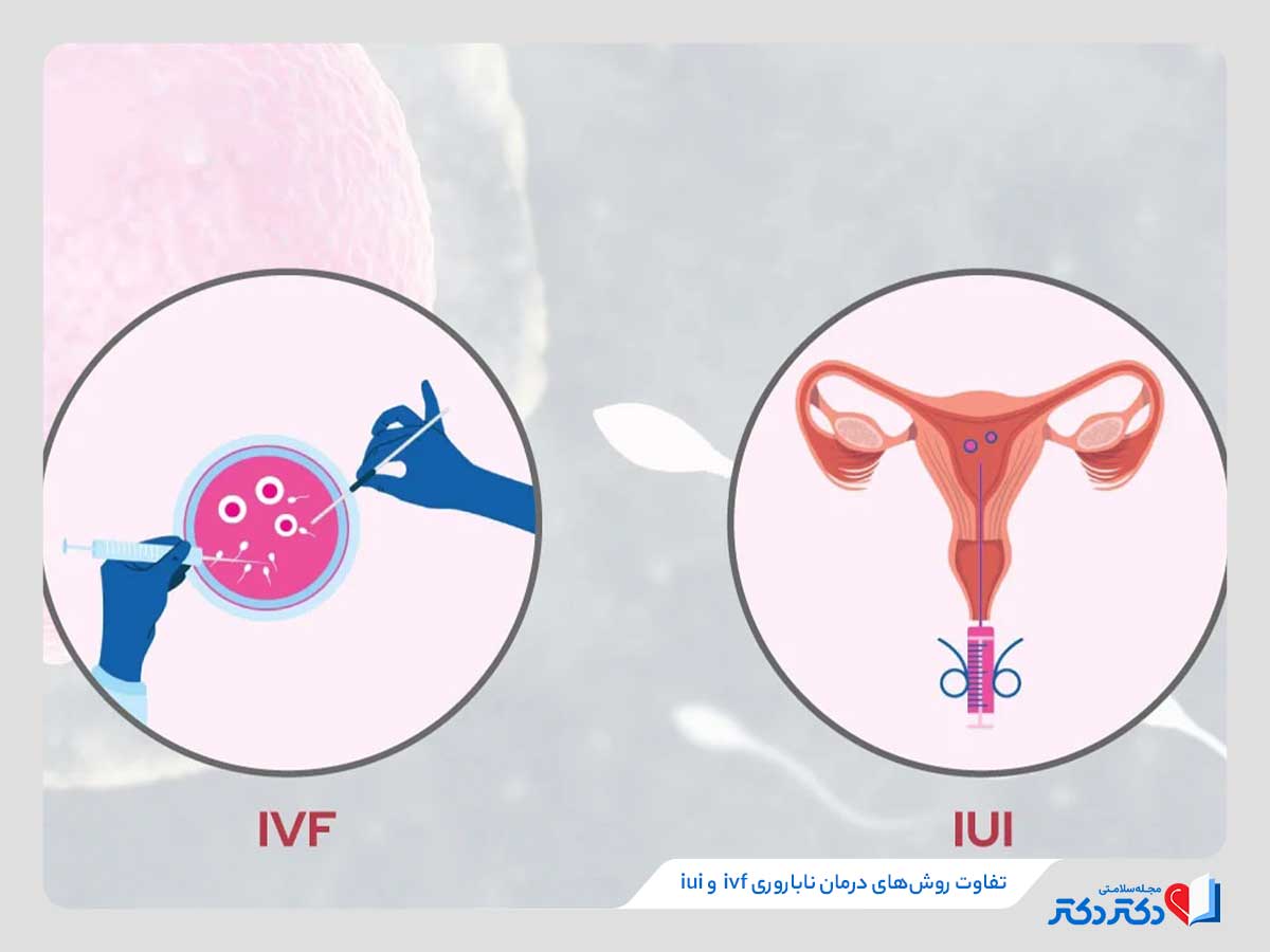 بازدید کامل تاثییر لقاح داخل رحمی یا آی یو آی بر درمان ناباروی_مستطیل زرد 26 تفاوت روشهای ivf و iui در درمان ناباروری