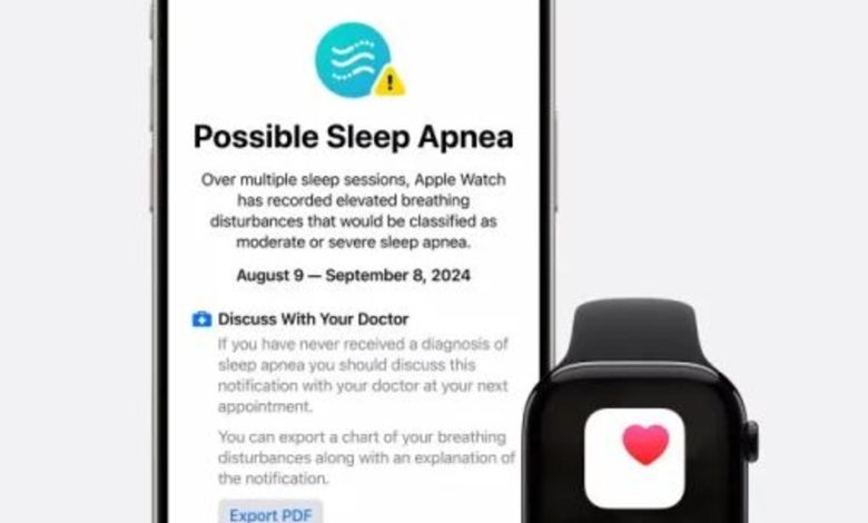 قابلیت تشخیص آپنه خواب در اپل واچ سری ۱۰