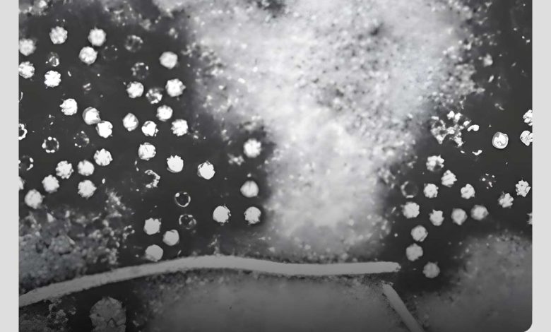 تصویر کبد آلوده به ویروس هپاتیت E در زیر میکروسکوپ