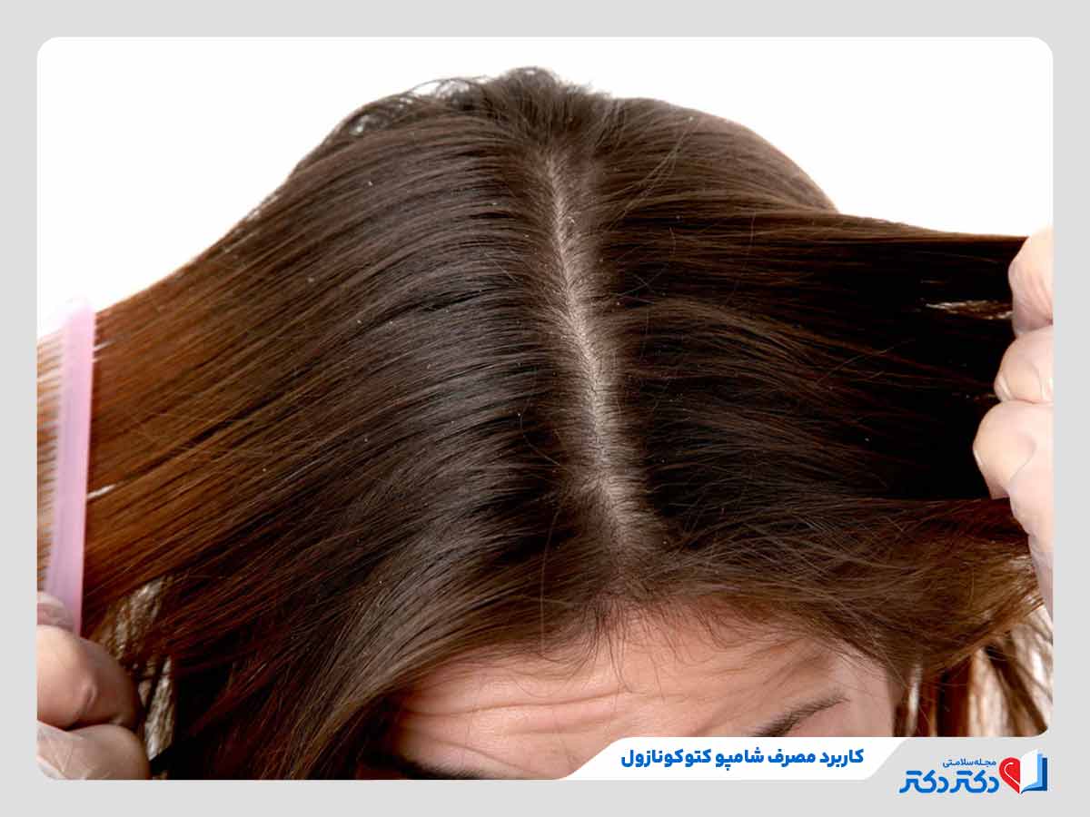 شامپو کتوکونازول چیست؟ بازدید انواع گوناگون این دارو + عوارض_مستطیل زرد 28 مکانیسم اثر شامپو کتوکونازول