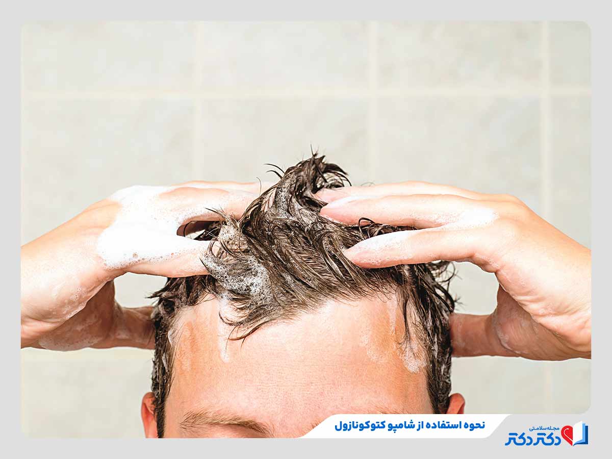 شامپو کتوکونازول چیست؟ بازدید انواع گوناگون این دارو + عوارض_مستطیل زرد 38 نحوه شستن موها با شامپو کتوکونازول