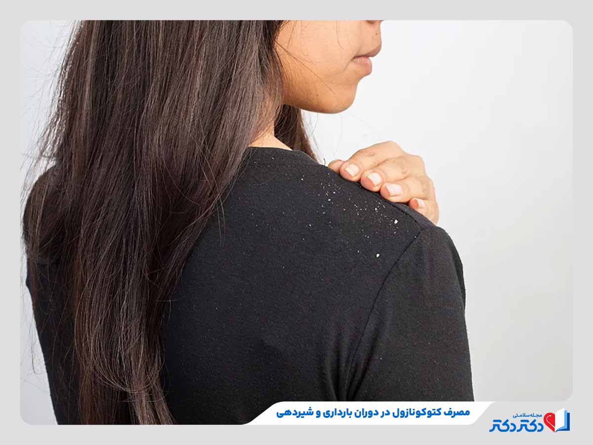 شامپو کتوکونازول چیست؟ بازدید انواع گوناگون این دارو + عوارض_مستطیل زرد 40 مشکلات مصرف داروی کتوکونازول در بارداری یا شیردهی