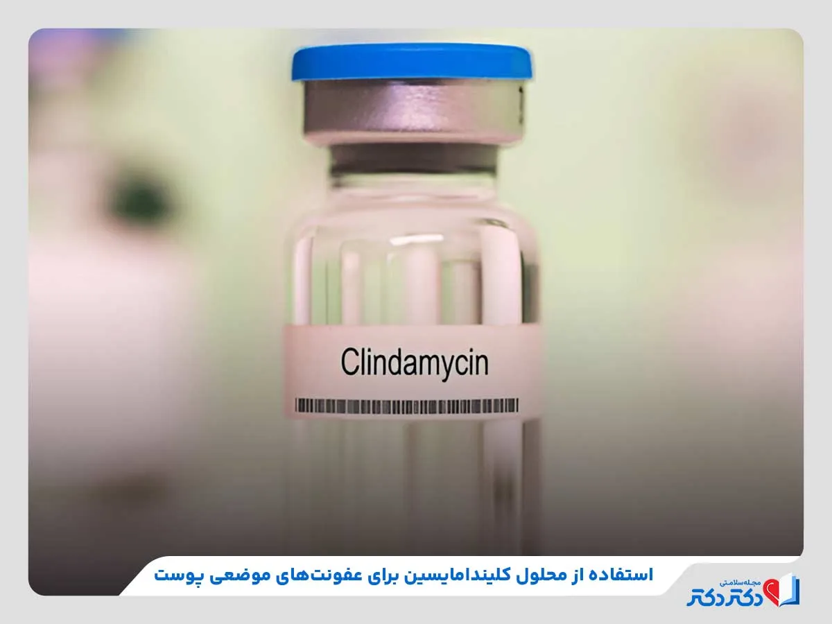 قرص کلیندامایسین | بهترین دارو برای درمان عفونت_مستطیل زرد 30 استفاده از ژل و محلول کلیندامایسین برای درمان عفونتهای موضعی پوست