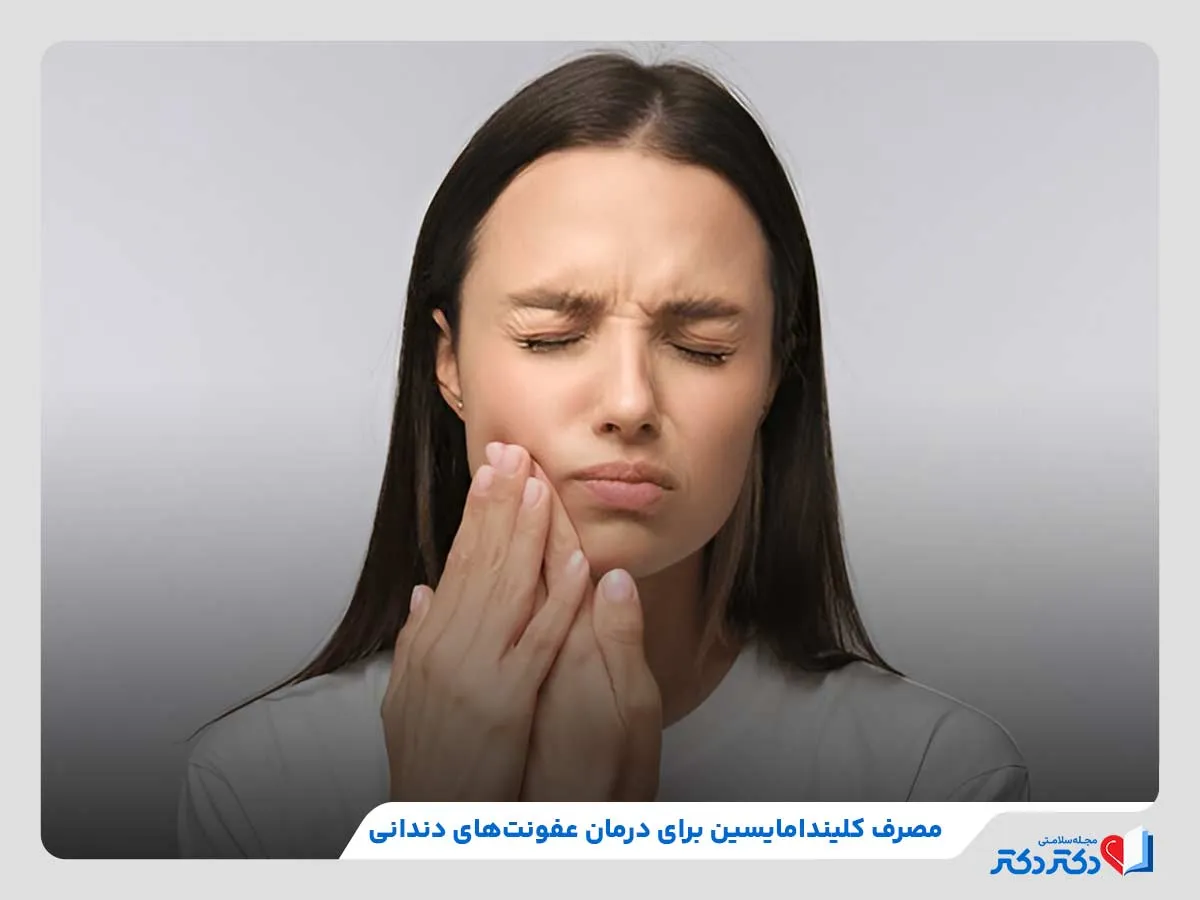 درمان عفونت‌های دندانی، یکی از کاربردهای داروی کلیندامایسین
