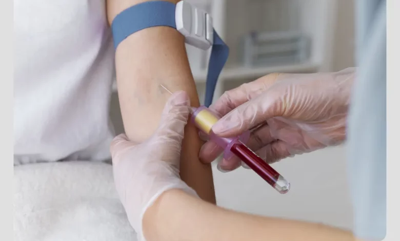 برای انجام آزمایش ویتامین دی، نیازی به ناشتایی نیست