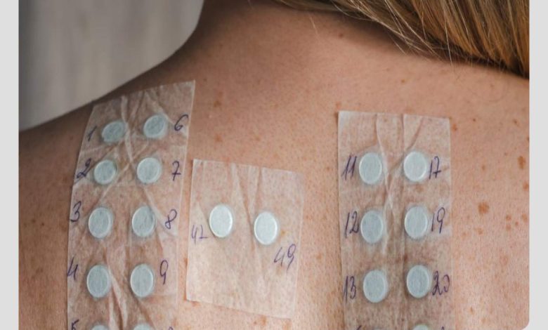 درمان انواع آلرژی همچون خارش و کهیر با فواید داروی لوو ستیریزین