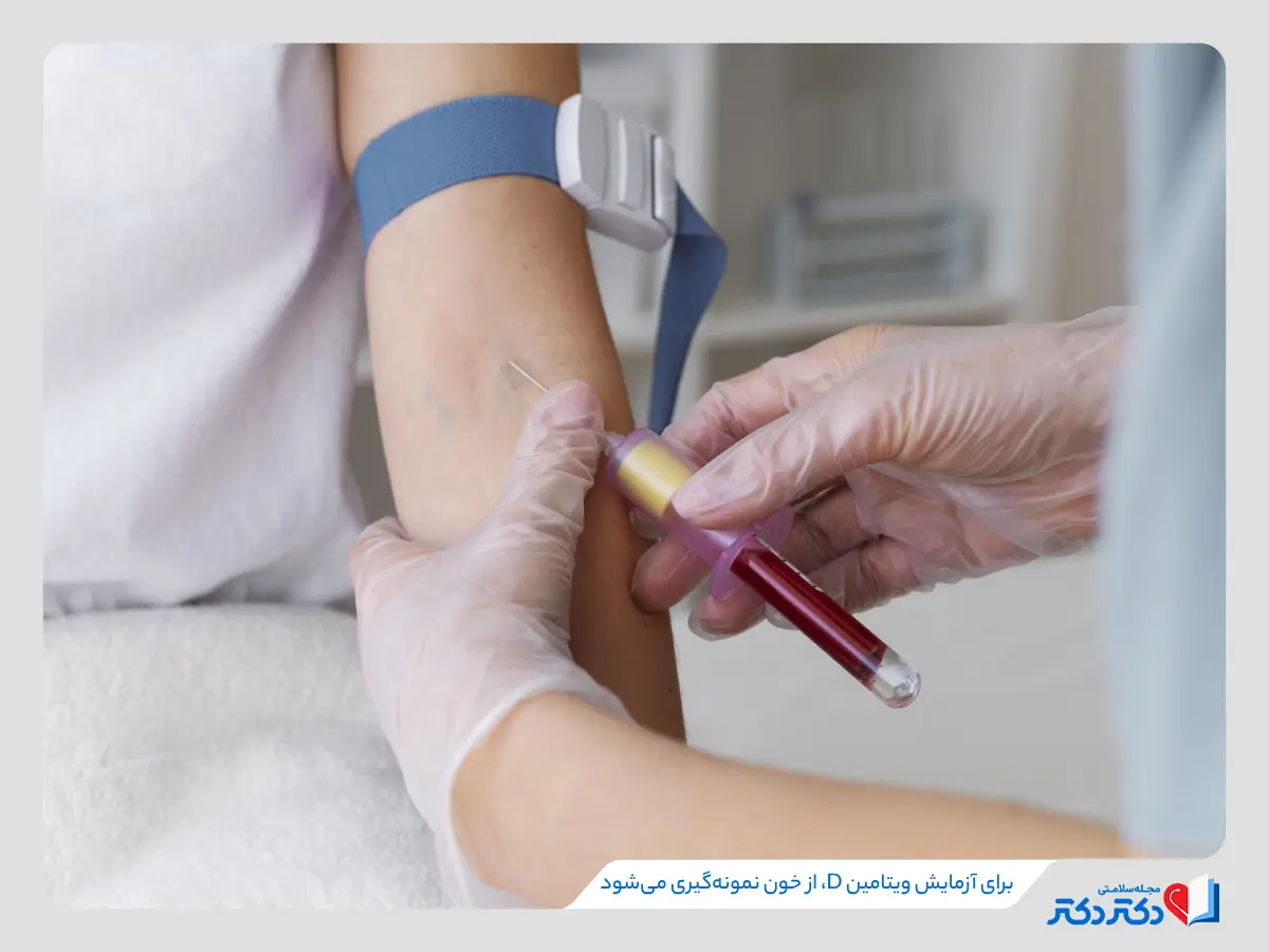 برای انجام آزمایش ویتامین دی، نیازی به ناشتایی نیست