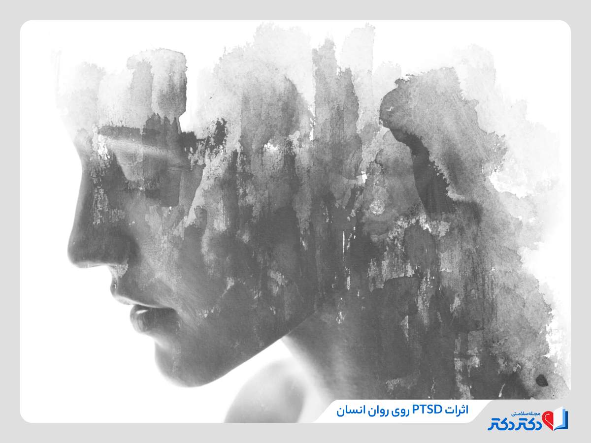 اثر اختلال اضطراب پس از سانحه