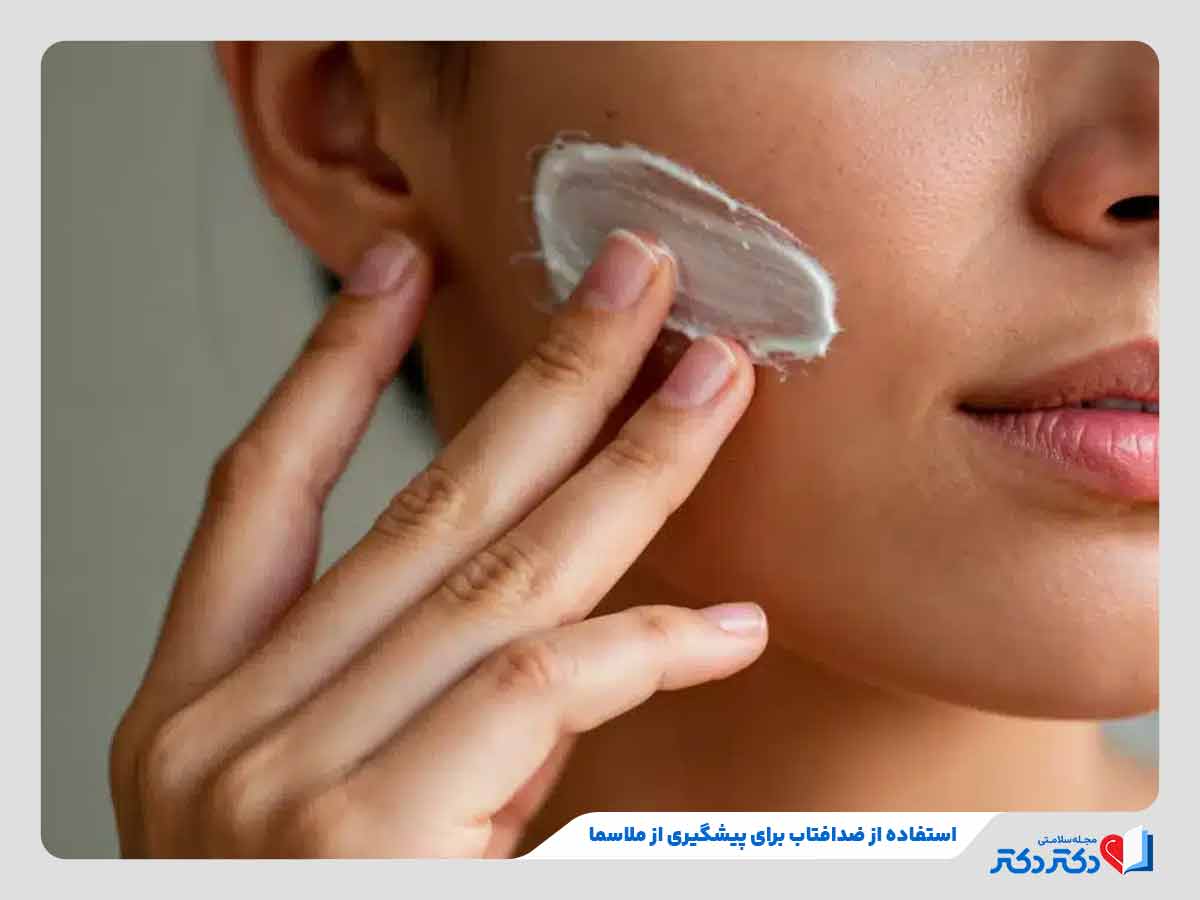 زن در حال استفاده از کرم ضدآفتاب برای پیشگیری از لک ملاسما