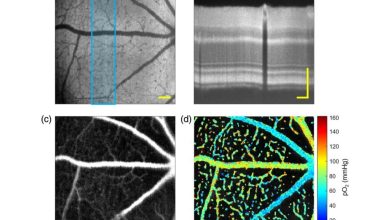 فناوری تصویربرداری جدید برای شناسایی زودهنگام بیماری‌های چشم
