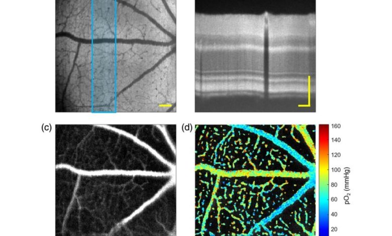 فناوری تصویربرداری جدید برای شناسایی زودهنگام بیماری‌های چشم