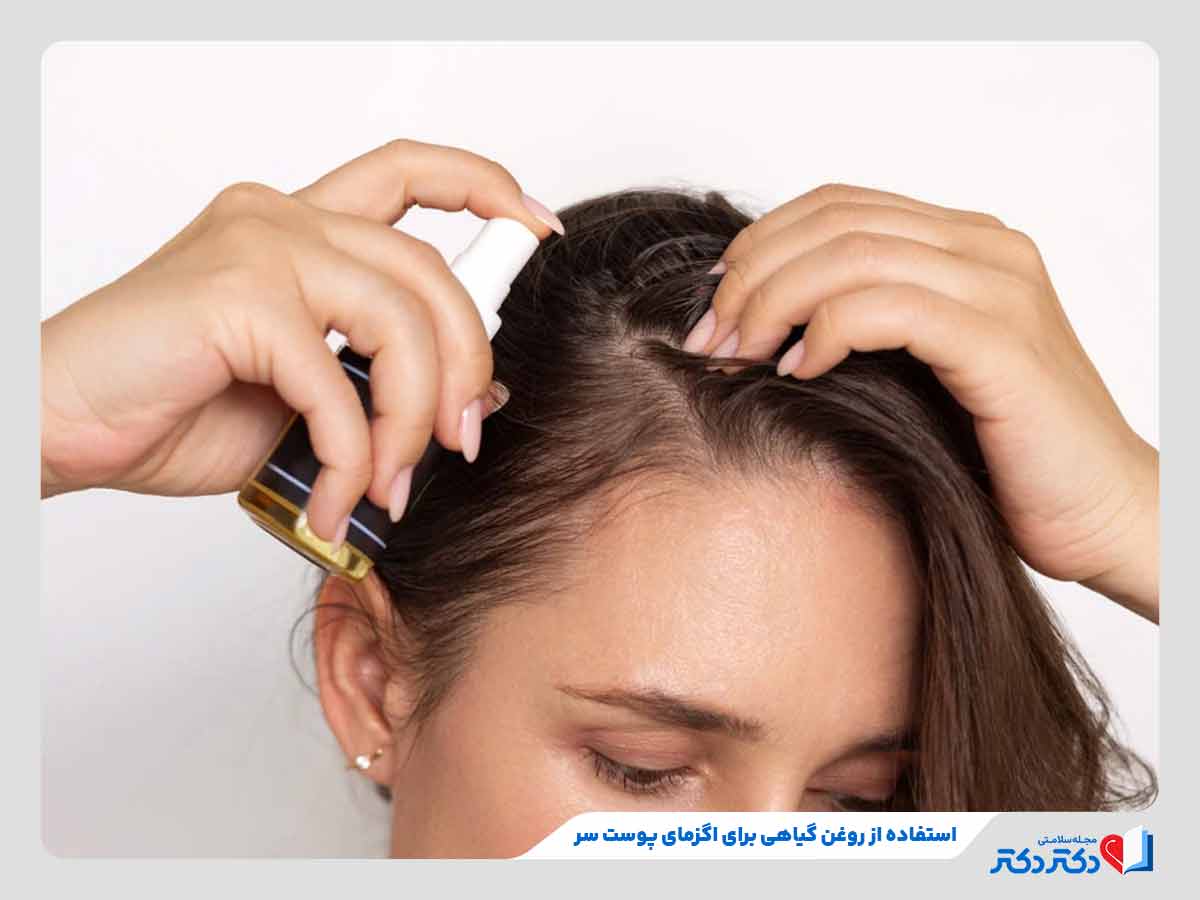 فرد در حال استفاده از روغن برای درمان درماتیت تماسی پوست سر